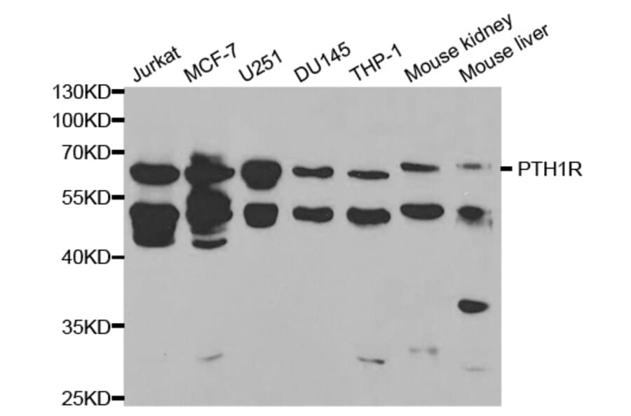 Western blot - PTH1R Antibody from Signalway Antibody (32412) - Antibodies.com
