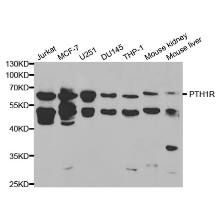 Western blot - PTH1R Antibody from Signalway Antibody (32412) - Antibodies.com