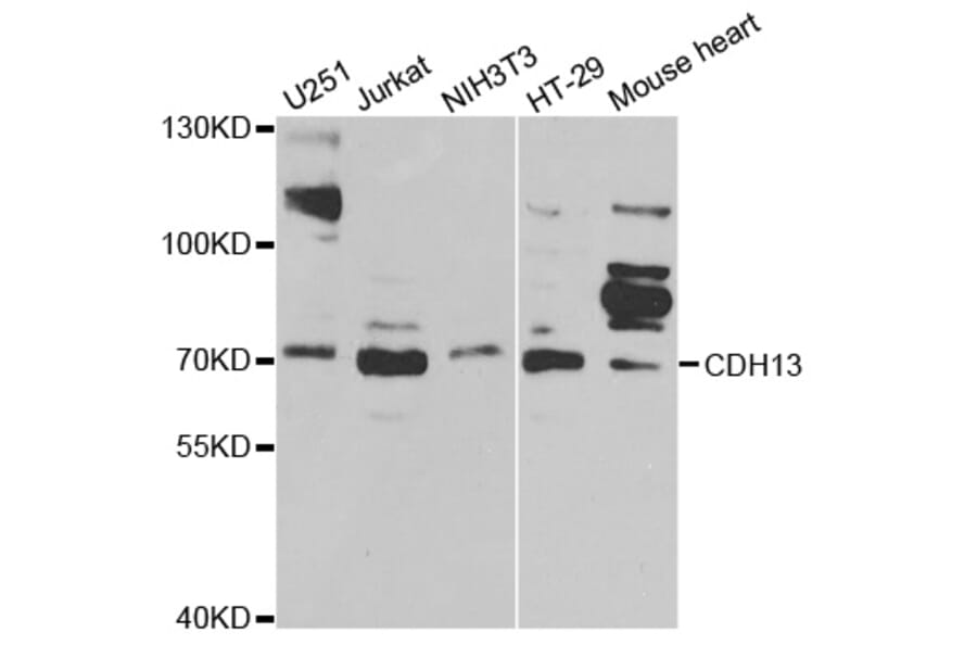 Western blot - CDH13 Antibody from Signalway Antibody (32420) - Antibodies.com