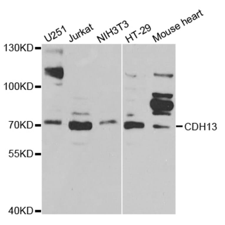 Western blot - CDH13 Antibody from Signalway Antibody (32420) - Antibodies.com