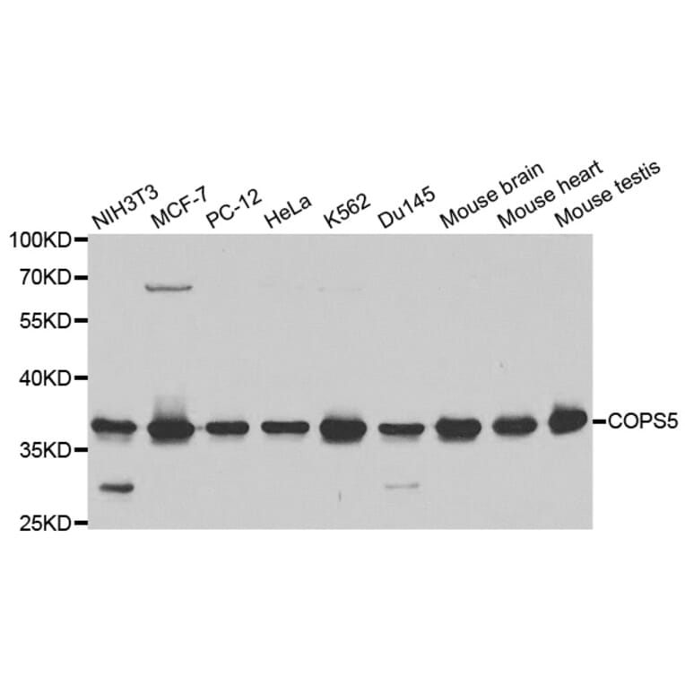 Western blot - COPS5 Antibody from Signalway Antibody (32423) - Antibodies.com