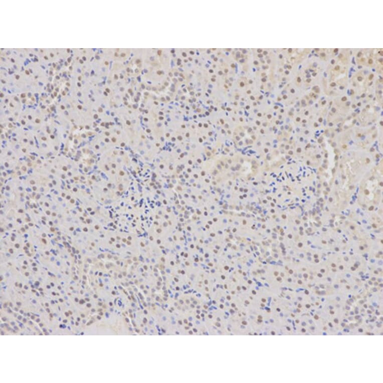 Immunohistochemistry - COPS5 Antibody from Signalway Antibody (32423) - Antibodies.com