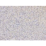 Immunohistochemistry - COPS5 Antibody from Signalway Antibody (32423) - Antibodies.com