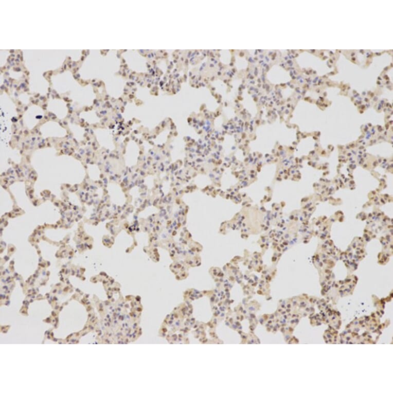 Immunohistochemistry - COPS5 Antibody from Signalway Antibody (32423) - Antibodies.com