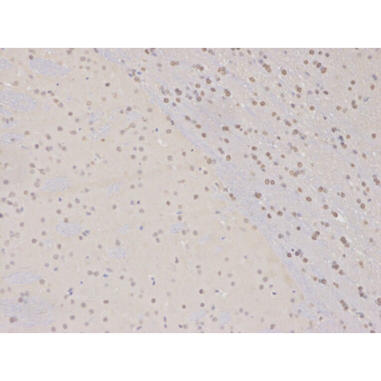 Immunohistochemistry - COPS5 Antibody from Signalway Antibody (32423) - Antibodies.com