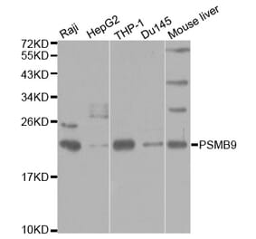 Western blot - PSMB9 Antibody from Signalway Antibody (32427) - Antibodies.com