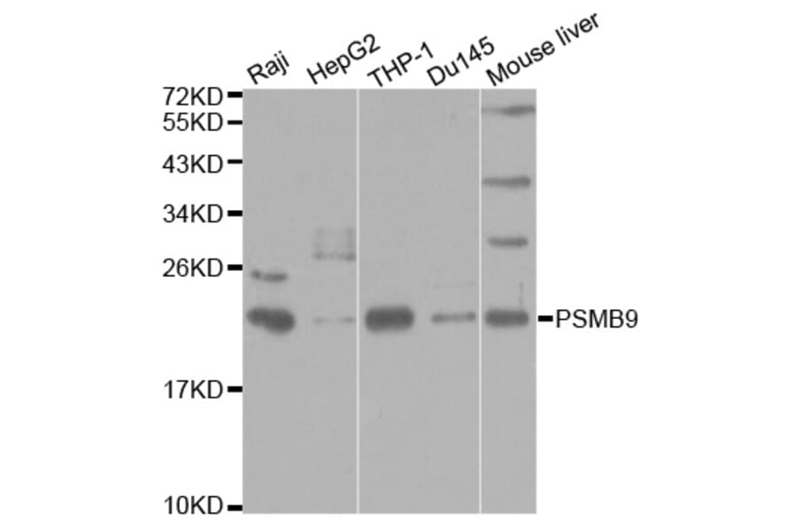 Western blot - PSMB9 Antibody from Signalway Antibody (32427) - Antibodies.com