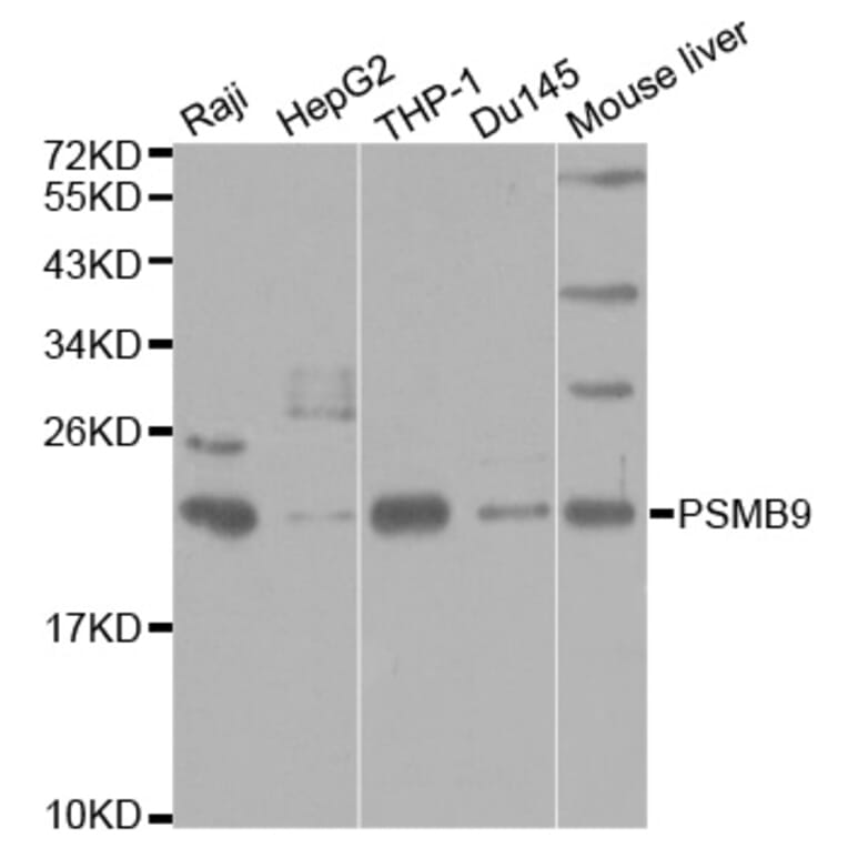 Western blot - PSMB9 Antibody from Signalway Antibody (32427) - Antibodies.com