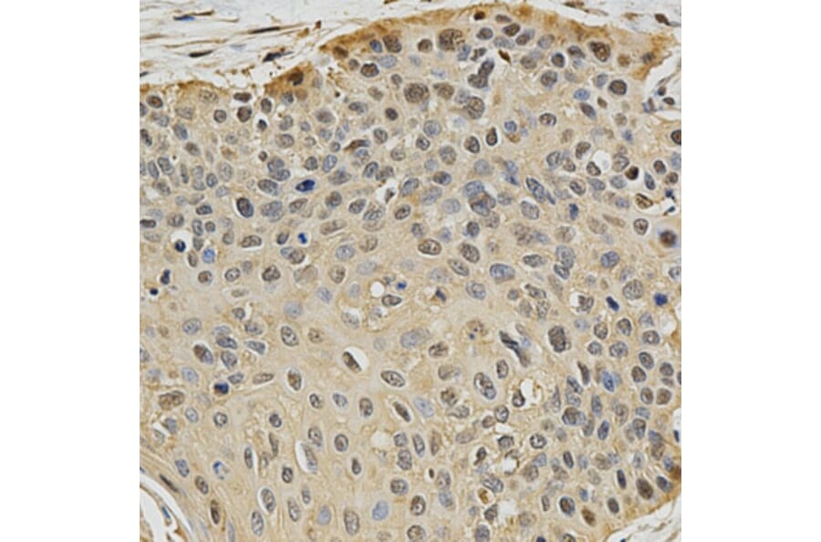 Immunohistochemistry - PSMB9 Antibody from Signalway Antibody (32427) - Antibodies.com