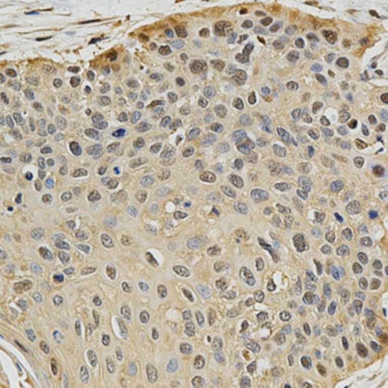 Immunohistochemistry - PSMB9 Antibody from Signalway Antibody (32427) - Antibodies.com