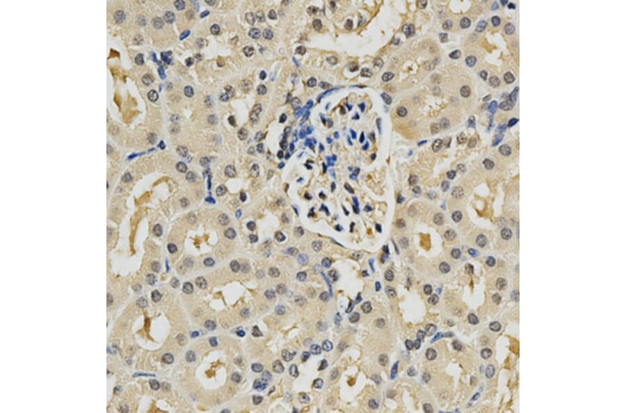 Immunohistochemistry - PSMB9 Antibody from Signalway Antibody (32427) - Antibodies.com