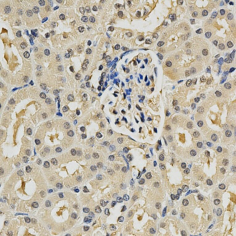 Immunohistochemistry - PSMB9 Antibody from Signalway Antibody (32427) - Antibodies.com