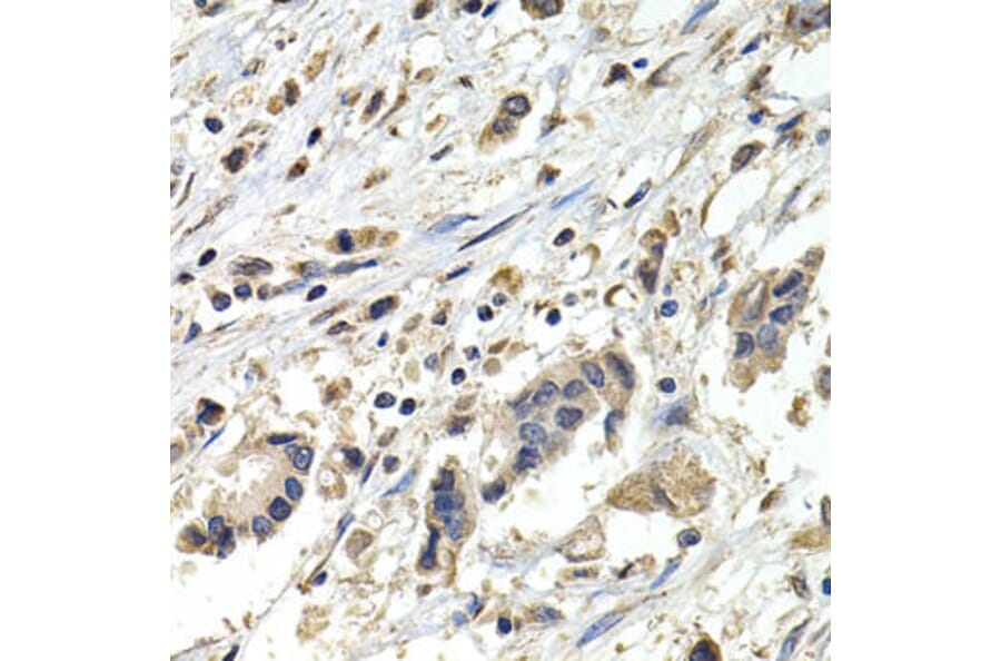 Immunohistochemistry - BUB1B Antibody from Signalway Antibody (32428) - Antibodies.com
