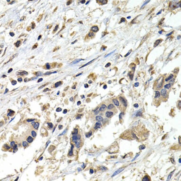 Immunohistochemistry - BUB1B Antibody from Signalway Antibody (32428) - Antibodies.com