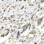 Immunohistochemistry - BUB1B Antibody from Signalway Antibody (32428) - Antibodies.com
