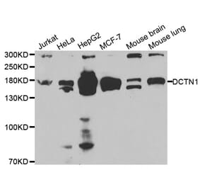 Western blot - DCTN1 Antibody from Signalway Antibody (32433) - Antibodies.com