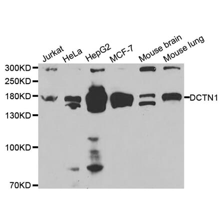 Western blot - DCTN1 Antibody from Signalway Antibody (32433) - Antibodies.com