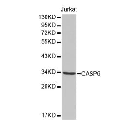 Western blot - CASP6 Antibody from Signalway Antibody (32434) - Antibodies.com