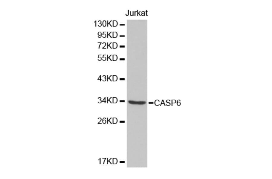 Western blot - CASP6 Antibody from Signalway Antibody (32434) - Antibodies.com