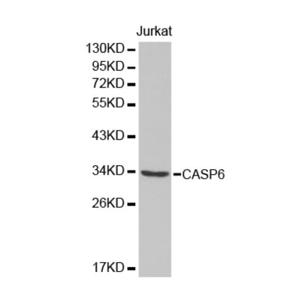 Western blot - CASP6 Antibody from Signalway Antibody (32434) - Antibodies.com