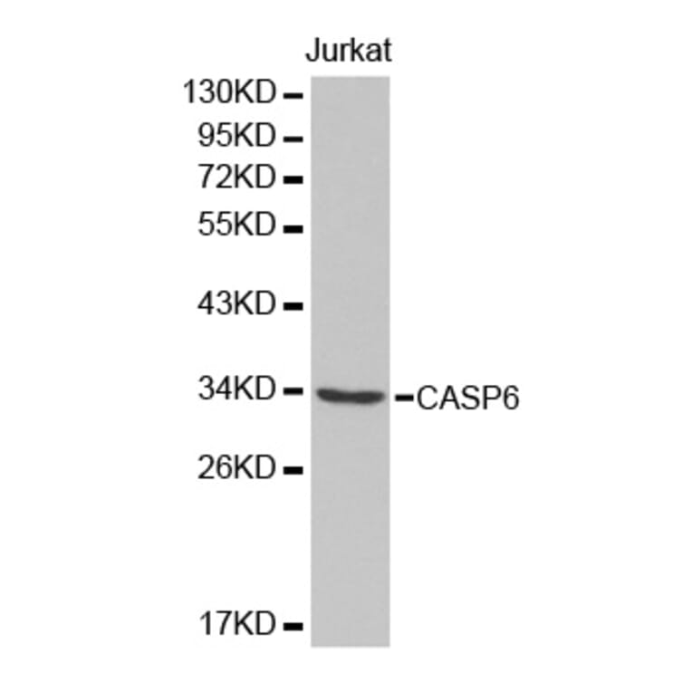 Western blot - CASP6 Antibody from Signalway Antibody (32434) - Antibodies.com