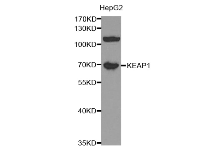 Western blot - KEAP1 Antibody from Signalway Antibody (32450) - Antibodies.com