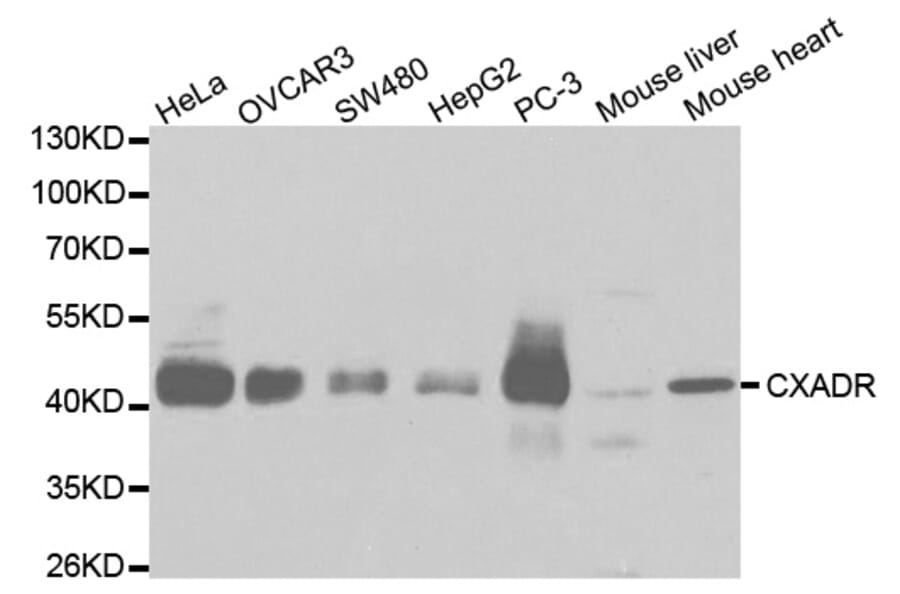 Western blot - CXADR Antibody from Signalway Antibody (32451) - Antibodies.com