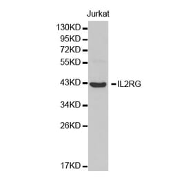 Western blot - IL2RG Antibody from Signalway Antibody (32456) - Antibodies.com