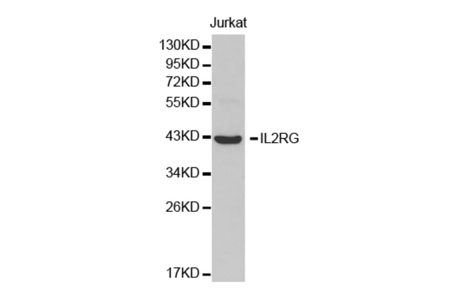 Western blot - IL2RG Antibody from Signalway Antibody (32456) - Antibodies.com