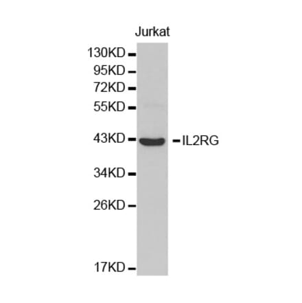 Western blot - IL2RG Antibody from Signalway Antibody (32456) - Antibodies.com