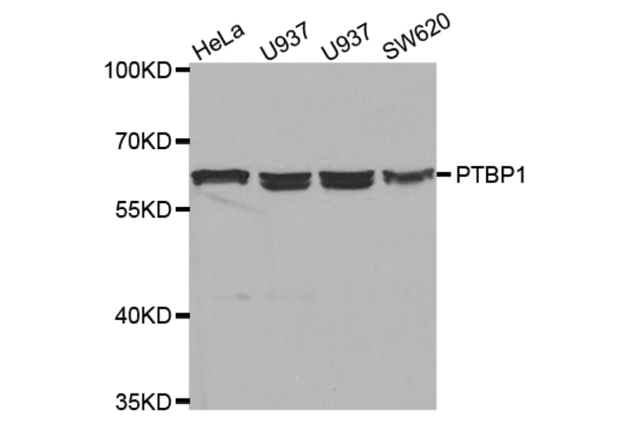 Western blot - PTBP1 Antibody from Signalway Antibody (32457) - Antibodies.com