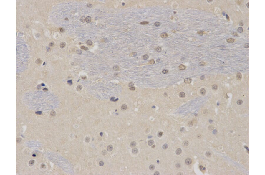 Immunohistochemistry - PTBP1 Antibody from Signalway Antibody (32457) - Antibodies.com
