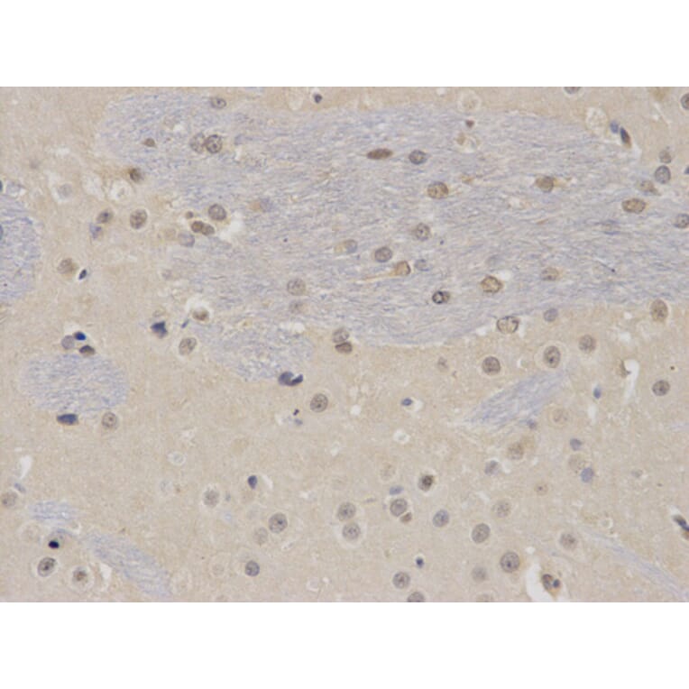 Immunohistochemistry - PTBP1 Antibody from Signalway Antibody (32457) - Antibodies.com