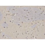 Immunohistochemistry - PTBP1 Antibody from Signalway Antibody (32457) - Antibodies.com