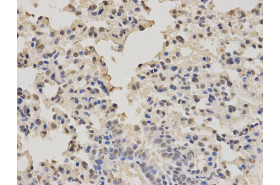 Immunohistochemistry - PTBP1 Antibody from Signalway Antibody (32457) - Antibodies.com
