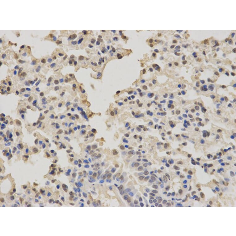 Immunohistochemistry - PTBP1 Antibody from Signalway Antibody (32457) - Antibodies.com