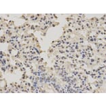 Immunohistochemistry - PTBP1 Antibody from Signalway Antibody (32457) - Antibodies.com