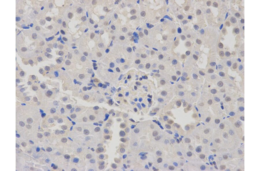 Immunohistochemistry - PTBP1 Antibody from Signalway Antibody (32457) - Antibodies.com