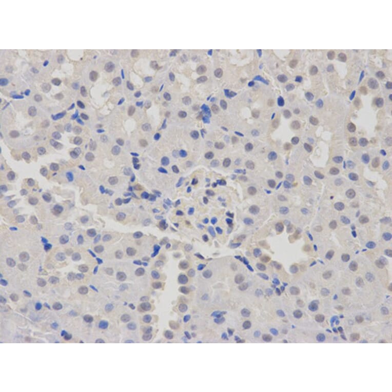 Immunohistochemistry - PTBP1 Antibody from Signalway Antibody (32457) - Antibodies.com