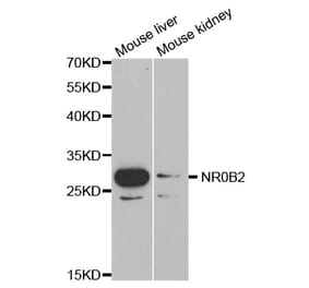 Western blot - NR0B2 Antibody from Signalway Antibody (32460) - Antibodies.com