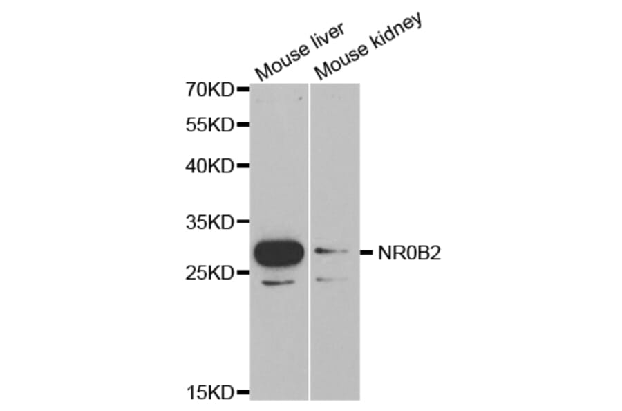 Western blot - NR0B2 Antibody from Signalway Antibody (32460) - Antibodies.com