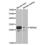 Western blot - NR0B2 Antibody from Signalway Antibody (32460) - Antibodies.com