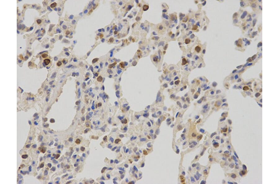 Immunohistochemistry - NR0B2 Antibody from Signalway Antibody (32460) - Antibodies.com