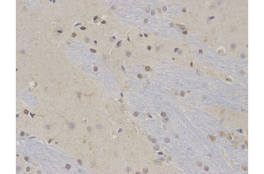 Immunohistochemistry - NR0B2 Antibody from Signalway Antibody (32460) - Antibodies.com