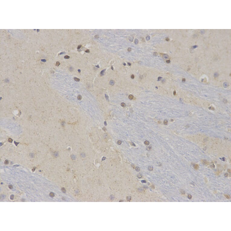 Immunohistochemistry - NR0B2 Antibody from Signalway Antibody (32460) - Antibodies.com