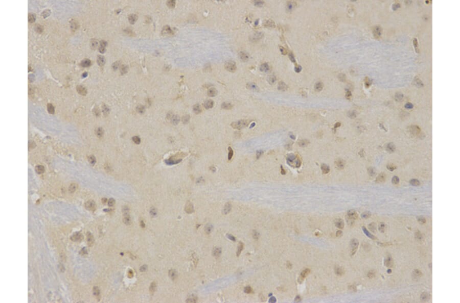 Immunohistochemistry - NR0B2 Antibody from Signalway Antibody (32460) - Antibodies.com