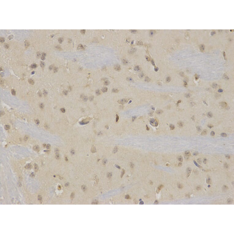 Immunohistochemistry - NR0B2 Antibody from Signalway Antibody (32460) - Antibodies.com