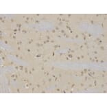 Immunohistochemistry - NR0B2 Antibody from Signalway Antibody (32460) - Antibodies.com