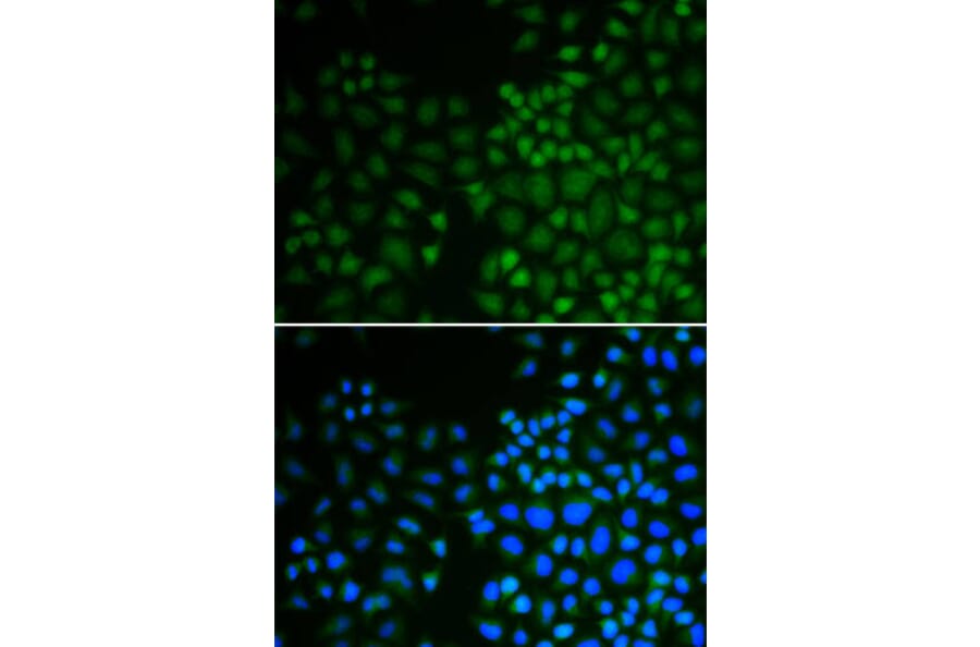 Immunofluorescence - NR0B2 Antibody from Signalway Antibody (32460) - Antibodies.com