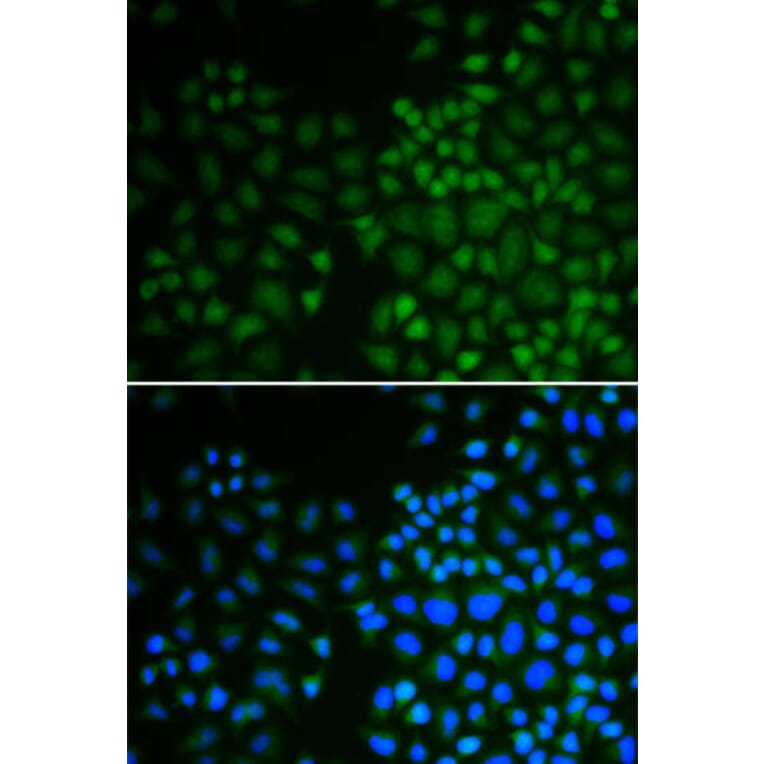 Immunofluorescence - NR0B2 Antibody from Signalway Antibody (32460) - Antibodies.com